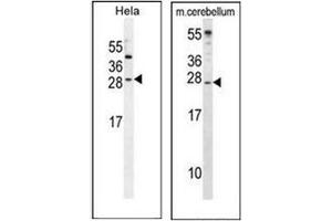 Image no. 3 for anti-Insulin-Like Growth Factor 2 (IGF2) (AA 46-77), (Middle Region) antibody (ABIN952912)