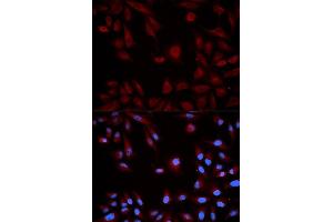 Immunofluorescence analysis of HeLa cell using STAT5B antibody.