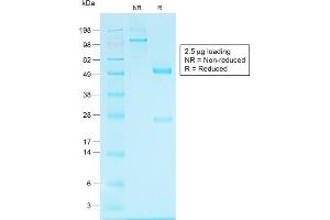 Image no. 1 for anti-Glypican 3 (GPC3) antibody (ABIN6939528)