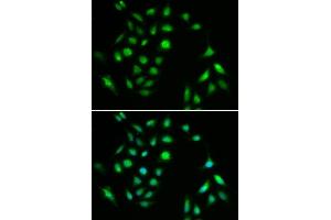 Image no. 6 for anti-conserved Helix-Loop-Helix Ubiquitous Kinase (CHUK) antibody (ABIN3022825)