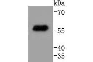 Image no. 2 for anti-Keratin 4 (KRT4) antibody (ABIN5557444)