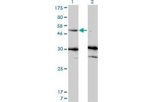 Image no. 3 for anti-Matrix Metallopeptidase 13 (Collagenase 3) (MMP13) (AA 362-471) antibody (ABIN517973)