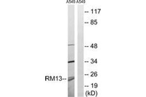 Image no. 1 for anti-Mitochondrial Ribosomal Protein L13 (MRPL13) (AA 121-170) antibody (ABIN1534518)