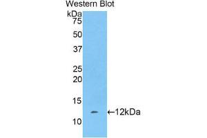 Image no. 1 for anti-Fibrinogen alpha Chain (FGA) (AA 554-655) antibody (ABIN1858851)