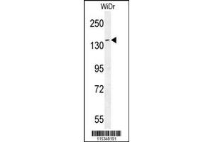 Western Blotting (WB) image for anti-Dishevelled Associated Activator of Morphogenesis 1 (DAAM1) antibody (ABIN2158477)