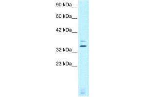 Image no. 1 for anti-Visual System Homeobox 2 (VSX2) (C-Term) antibody (ABIN2777528)