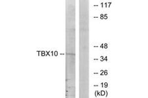 Image no. 1 for anti-T-Box 10 (TBX10) (AA 261-310) antibody (ABIN1533531)
