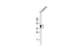 Image no. 2 for anti-Haptoglobin (HP) (AA 212-240) antibody (ABIN5535407)
