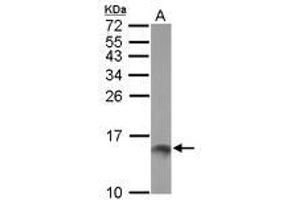 Image no. 2 for anti-Trefoil Factor 1 (TFF1) (AA 1-84) antibody (ABIN1501358)