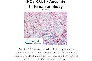 Image no. 1 for anti-Kallmann Syndrome 1 Sequence (KAL1) (Internal Region) antibody (ABIN1736141)