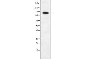 SIN3B 抗体  (Internal Region)