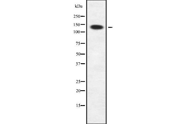 SIN3B 抗体  (Internal Region)