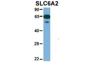 Image no. 4 for anti-Solute Carrier Family 6 (Neurotransmitter Transporter, Noradrenalin), Member 2 (SLC6A2) (Middle Region) antibody (ABIN2777051)