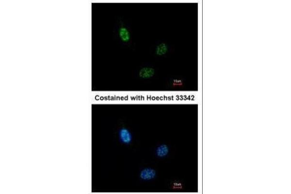 anti-Cleavage and Polyadenylation Factor I Subunit 1 (CLP1) (Center) antibody