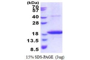 Image no. 1 for STEAP Family Member 4 (STEAP4) (AA 1-152) protein (His tag) (ABIN5853589)