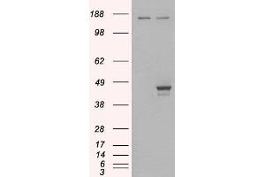 Image no. 1 for anti-E74-Like Factor 3 (Ets Domain Transcription Factor, Epithelial-Specific) (ELF3) (C-Term) antibody (ABIN184777)