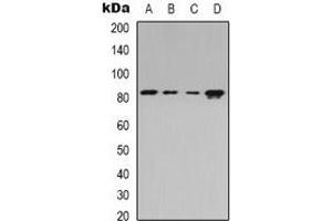 Image no. 2 for anti-Adducin 2 (Beta) (ADD2) antibody (ABIN2957876)