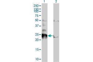 Image no. 2 for anti-BCL2/adenovirus E1B 19kDa Interacting Protein 1 (BNIP1) (AA 1-228) antibody (ABIN513790)