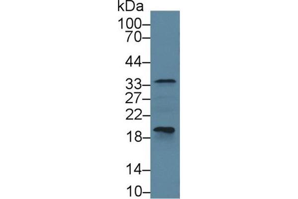 Caspase 6 antibody  (AA 194-293)