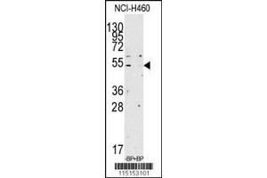 Image no. 1 for anti-Apolipoprotein A-IV (APOA4) (AA 49-79), (N-Term) antibody (ABIN391854)