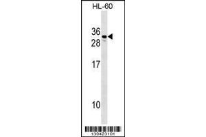 Image no. 1 for anti-Chorionic Gonadotropin, beta Polypeptide 1 (CGB) (AA 1-30), (N-Term) antibody (ABIN1538841)