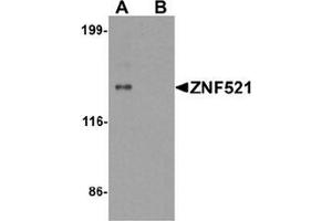 Image no. 2 for anti-Zinc Finger Protein 521 (ZNF521) (N-Term) antibody (ABIN1449926)