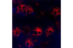 Image no. 4 for anti-Cathelicidin Antimicrobial Peptide (CAMP) antibody (ABIN571374)