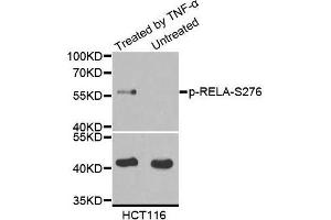 Image no. 1 for anti-Nuclear Factor-kB p65 (NFkBP65) (pSer276) antibody (ABIN1682005)