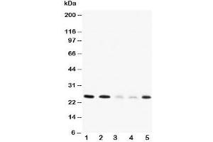 Western blot testing of Pleiotrophin antibody and Lane 1:  rat brain;  2: rat kidney;  3: MCF-7;  4: HT1080;  5: SMMC-7721 cell lysate