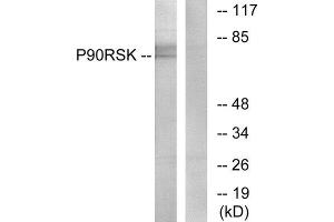 Image no. 2 for anti-Ribosomal Protein S6 Kinase, 90kDa, Polypeptide 3 (RPS6KA3) (Thr573) antibody (ABIN1847962)