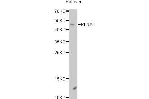 Image no. 1 for anti-Killer Cell Lectin-Like Receptor Subfamily B, Member 1 (KLRB1) antibody (ABIN6570787)