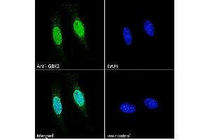 Image no. 7 for anti-Gastrulation Brain Homeo Box 2 (GBX2) (Internal Region) antibody (ABIN334408)