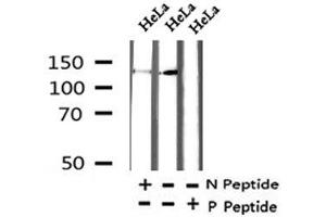 Image no. 2 for anti-P21-Activated Kinase 2 (PAK2) (pSer815) antibody (ABIN6270224)