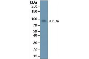 Image no. 2 for Matrix Metallopeptidase 9 (Gelatinase B, 92kDa Gelatinase, 92kDa Type IV Collagenase) (MMP9) ELISA Kit (ABIN6574164)