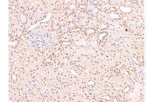 Image no. 9 for anti-Linker For Activation of T Cells (LAT) (pTyr161) antibody (ABIN6271566)