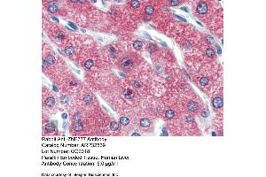 Image no. 1 for anti-Zinc Finger Protein 777 (ZNF777) (Middle Region) antibody (ABIN2779728)