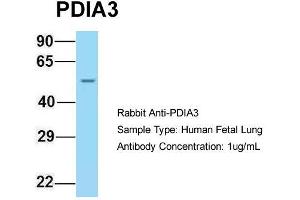 Image no. 3 for anti-Protein Disulfide Isomerase Family A, Member 3 (PDIA3) (C-Term) antibody (ABIN2774375)