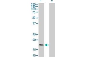 Western Blot analysis of PLA2G12A expression in transfected 293T cell line by PLA2G12A polyclonal antibody (A01).