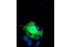 Image no. 1 for anti-Kinesin Family Member 2C (KIF2C) antibody (ABIN2724241)