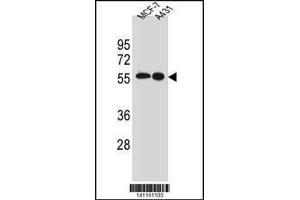 Image no. 4 for anti-Proto-oncogene tyrosine-protein kinase Src (Src) (AA 24-52), (N-Term) antibody (ABIN1881833)