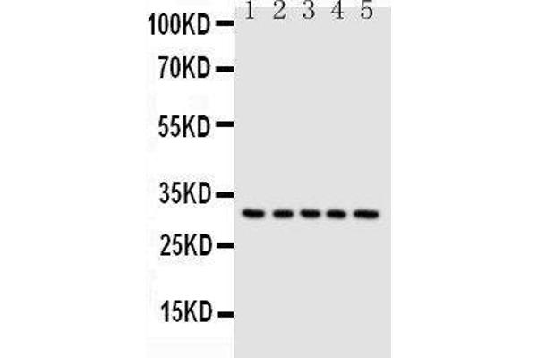 Caspase 6 Antikörper  (N-Term)