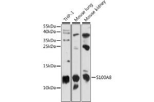 S100A8 抗体  (AA 1-93)