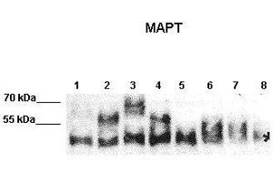 Image no. 2 for anti-Microtubule-Associated Protein tau (MAPT) (Middle Region) antibody (ABIN2783223)
