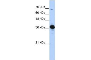 Image no. 1 for anti-ATPase, H+ Transporting, Lysosomal 38kDa, V0 Subunit D2 (ATP6V0D2) (Middle Region) antibody (ABIN2786234)