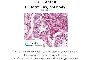 Image no. 1 for anti-G Protein-Coupled Receptor 64 (GPR64) (C-Term) antibody (ABIN1735145)