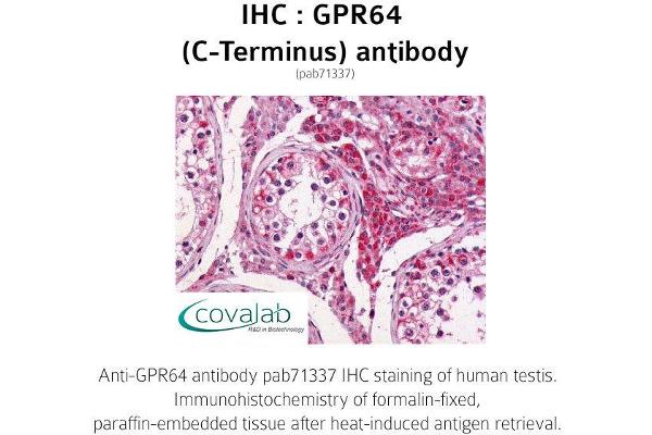 GPR64 Antikörper  (C-Term)
