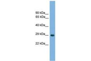 Image no. 1 for anti-NK1 Homeobox 2 (NKX1-2) (AA 101-150) antibody (ABIN6744551)