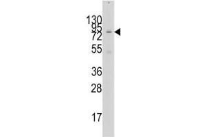 Image no. 2 for anti-K(lysine) Acetyltransferase 2A (KAT2A) (AA 65-94) antibody (ABIN3028777)