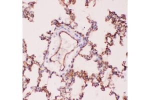 Image no. 4 for anti-Angiotensin I Converting Enzyme (Peptidyl-Dipeptidase A) 1 (ACE) (AA 651-864) antibody (ABIN3043777)