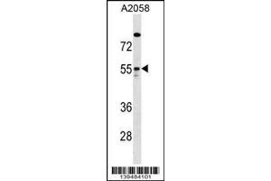 Western Blotting (WB) image for anti-rho GTPase Activating Protein 1 (ARHGAP1) (Center) antibody (ABIN2159229)